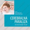 Cerebralna paraliza: multidisciplinarni pristup 36145