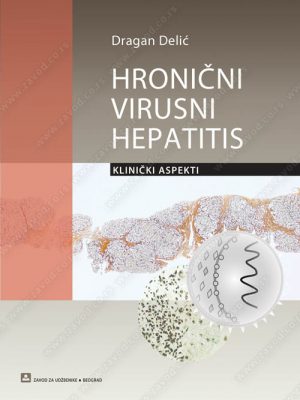 Hronični virusni hepatitis - klinički aspekti 36367