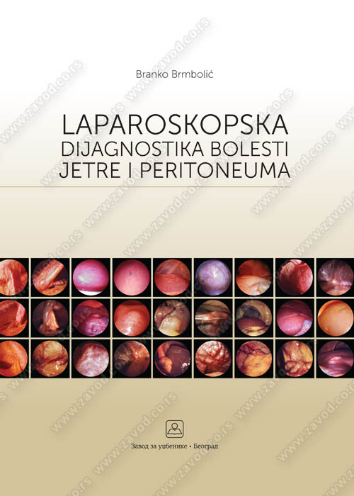 Laparoskopska dijagnostika bolesti jetre i peritoneuma 36165