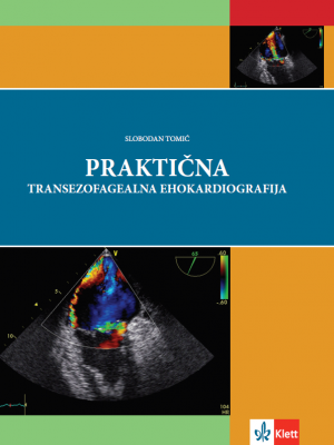 Praktična transezofagealna ehokardiografija